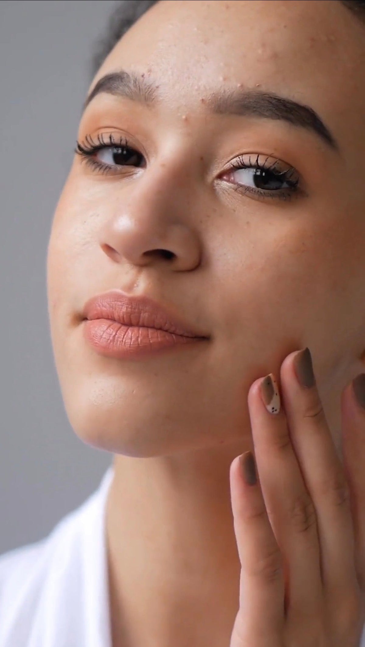 Comparative Acne Treatments: Traditional Methods vs Innovative Techniques