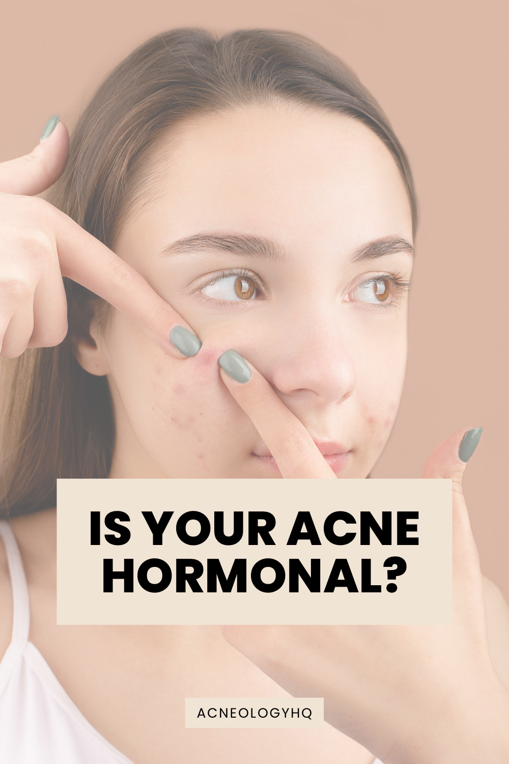 How to Know If Your Acne Is Hormonal: Jawline, Chin and Cycle Patterns Explained